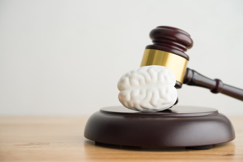 Photo of brain injury